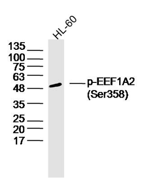 Phospho-EEF1A2 (Ser358) Rabbit Polyclonal Antibody