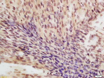 EIF4A3 Rabbit Polyclonal Antibody