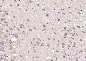 EMR4 Rabbit Polyclonal Antibody