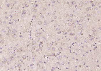 EMR4 Rabbit Polyclonal Antibody