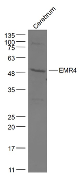 EMR4 Rabbit Polyclonal Antibody