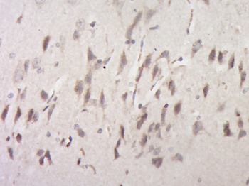 ENOX2 Rabbit Polyclonal Antibody