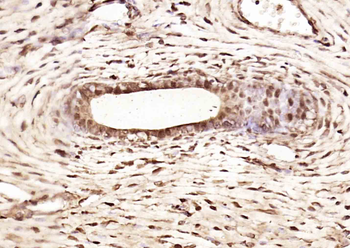 HnRNP H3 Rabbit Polyclonal Antibody