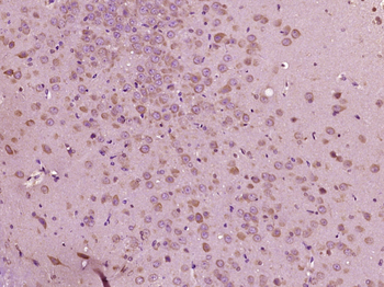 HPCAL4 Rabbit Polyclonal Antibody