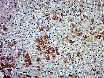 HKDC1 Rabbit Polyclonal Antibody