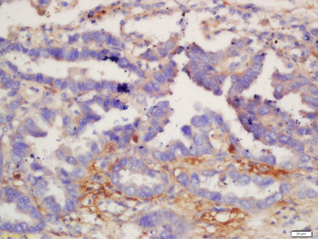 IL12B Rabbit Polyclonal Antibody