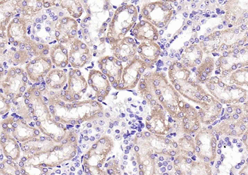 IREB2 Rabbit Polyclonal Antibody