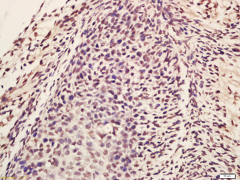 Lin28 Rabbit Polyclonal Antibody
