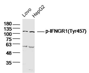 Phospho-Insulin Receptor (Tyr999) Rabbit Polyclonal Antibody