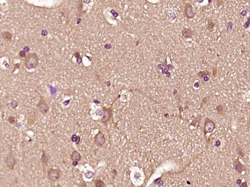 IGLC1 Rabbit Polyclonal Antibody