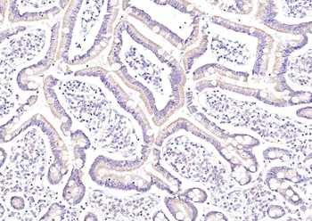 IL34 Rabbit Polyclonal Antibody
