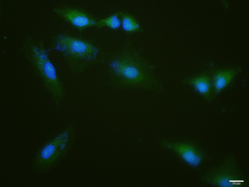 KEAP1 Rabbit Polyclonal Antibody