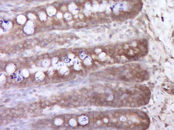 KIAA0753 Rabbit Polyclonal Antibody