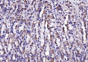 LPA2 Rabbit Polyclonal Antibody