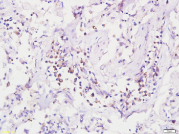 LASP1 Rabbit Polyclonal Antibody