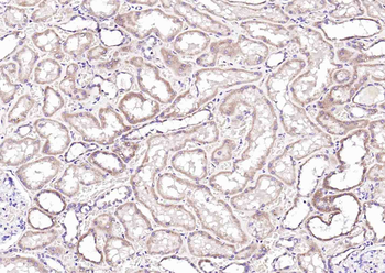 LACTB Rabbit Polyclonal Antibody
