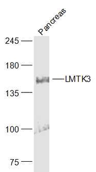 LMTK3 Rabbit Polyclonal Antibody