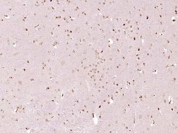 MEPCE Rabbit Polyclonal Antibody