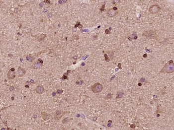 MEX3D/RNF193 Rabbit Polyclonal Antibody