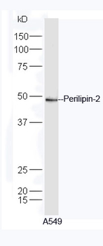 Perilipin-2 Rabbit Polyclonal Antibody