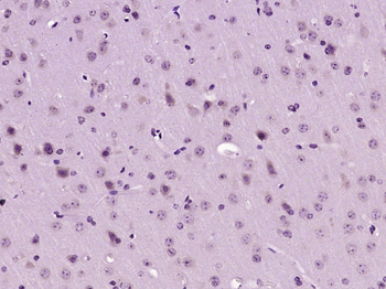 PGAM5 Rabbit Polyclonal Antibody