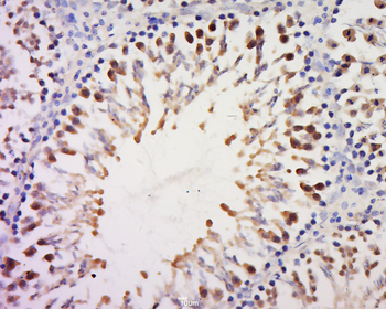 RPS20 Rabbit Polyclonal Antibody