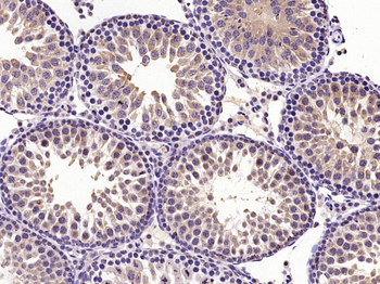 SRC Rabbit Polyclonal Antibody