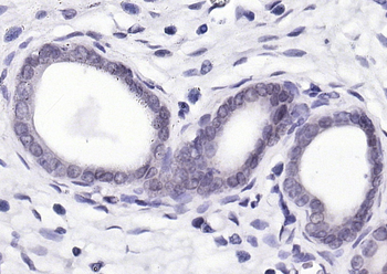 SRC Rabbit Polyclonal Antibody