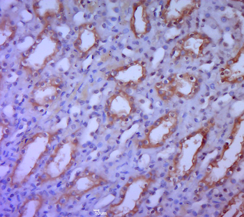 SAV1 Rabbit Polyclonal Antibody
