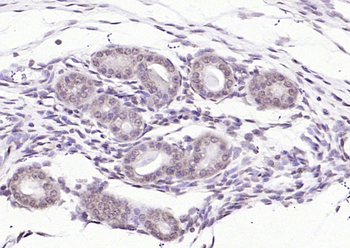 SBNO1 Rabbit Polyclonal Antibody
