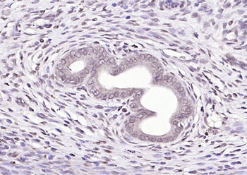 SBNO1 Rabbit Polyclonal Antibody