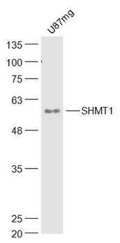 SHMT1 Rabbit Polyclonal Antibody
