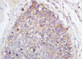TLR2 Rabbit Polyclonal Antibody