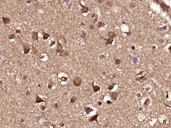 TRIM64 Rabbit Polyclonal Antibody