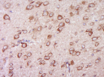 TRIP11/TRIP230 Rabbit Polyclonal Antibody