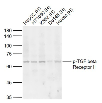 Phospho-TGF beta Receptor II (Tyr259) Rabbit Polyclonal Antibody
