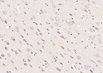 Tollip Rabbit Polyclonal Antibody