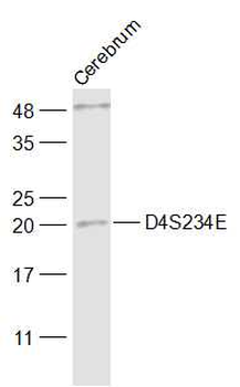 D4S234E Rabbit Polyclonal Antibody
