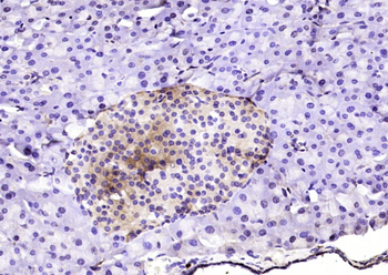 PAPSS1 Rabbit Polyclonal Antibody