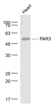 PAR3 Rabbit Polyclonal Antibody