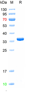 Recombinant human Perilipin A protein, N-Trx-His