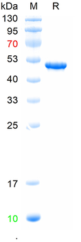 Recombinant SARS-Cov-2 N protein (EG.5/BA.4/BA.4.6)（P13L,DEL31-33,R203K,G204R,S413R）,N-His