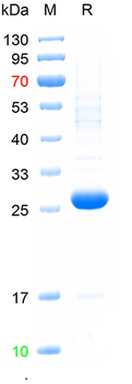 Recombinant human Collagen IV protein, N-His