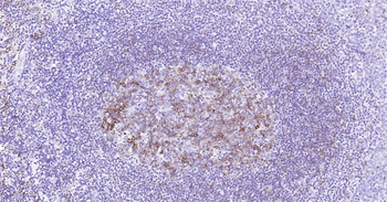 Human HLA-DR Ready-To-Use IHC Kit