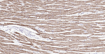 COX4I1(Mitochondrial Loading Control) Ready-To-Use IHC Kit