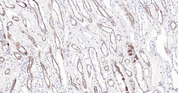 COX4I1(Mitochondrial Loading Control) Ready-To-Use IHC Kit