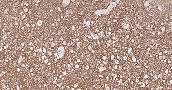 Synaptophysin Ready-To-Use IHC Kit