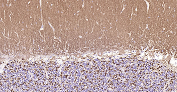 Synaptophysin Ready-To-Use IHC Kit