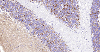 Mouse SYP Ready-To-Use IHC Kit