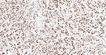 ERCC1 Ready-To-Use IHC Kit